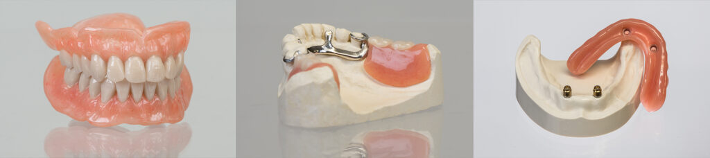 Complete dentures, a partial denture, and an implant retained denture.
