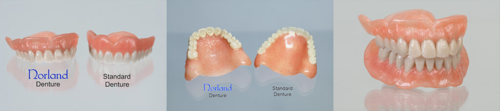 High quality Norland dentures compared to generic standard dentures.